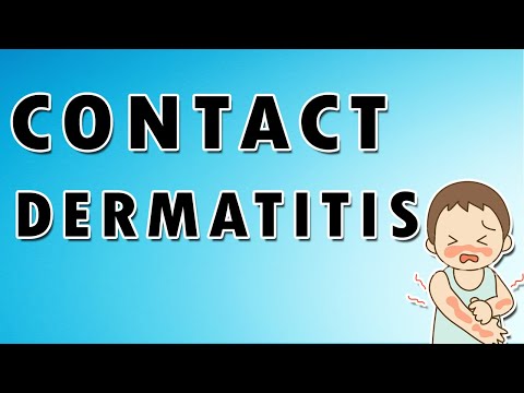 Contact Dermatitis Symptoms, Treatment, and Causes [Video]