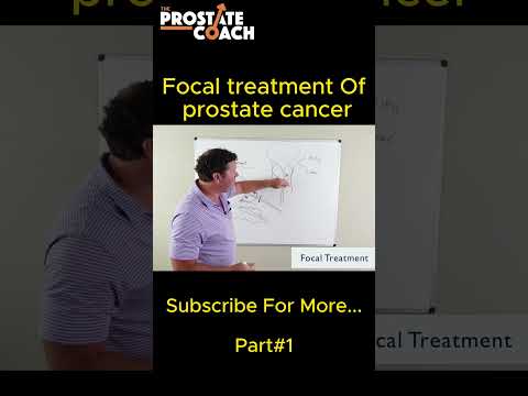 Am I a good candidate for focal treatment of prostate cancer  [Video]