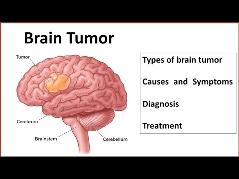 Brain tumor | Brain Cancer | Types, Causes, Symptoms, Diagnosis, Treatment [Video]
