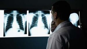 FDA Approves New Drug for Deadly Lung Cancer [Video]