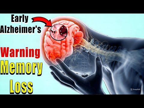BRAIN is DYING! 12 Weird Signs of BRAIN CANCER | Dr. John [Video]