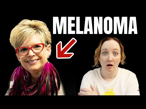 I’M PROUD OF MY SCAR | Carol’s MELANOMA CANCER Diagnosis Story [Video]