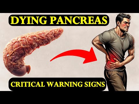 11 CRITICAL SIGNS OF PANCREATIC CANCER YOU DON’T KNOW – How To Deal With Them [Video]