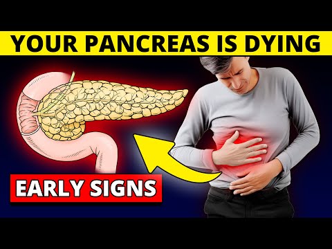 Your Pancreas is DYING! 10 Deadly Signs of Pancreatic Cancer You Shouldn’t Avoid [Video]