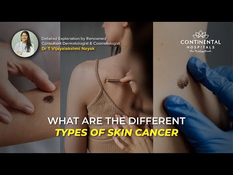 Types of Skin Cancer? Dr. T. Vijayalakshmi – Best Dermatologist & Cosmetologist Hyderabad [Video]