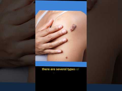 TOP 8 SiGNS OF SKIN CANCER [Video]
