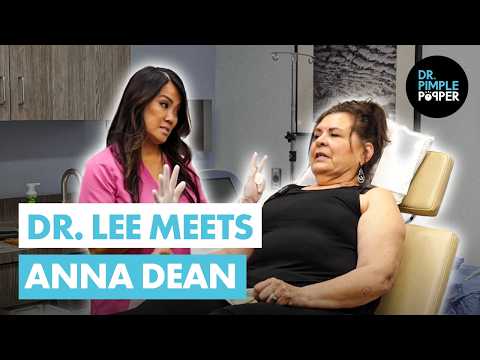 Dr Lee Meets Anna Dean and Her 12 Massive Lipomas! | Dr. Pimple Popper Ep. 1 [Video]
