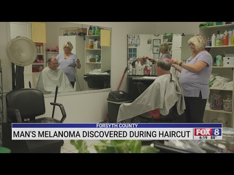 Man melanoma discovered during haircut in Forsyth County [Video]