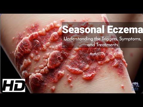 Eczema and the Seasons: Triggers, Symptoms, and Effective Solutions! [Video]