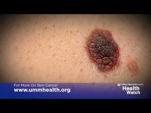 Health Watch: Skin Cancer Basics [Video]