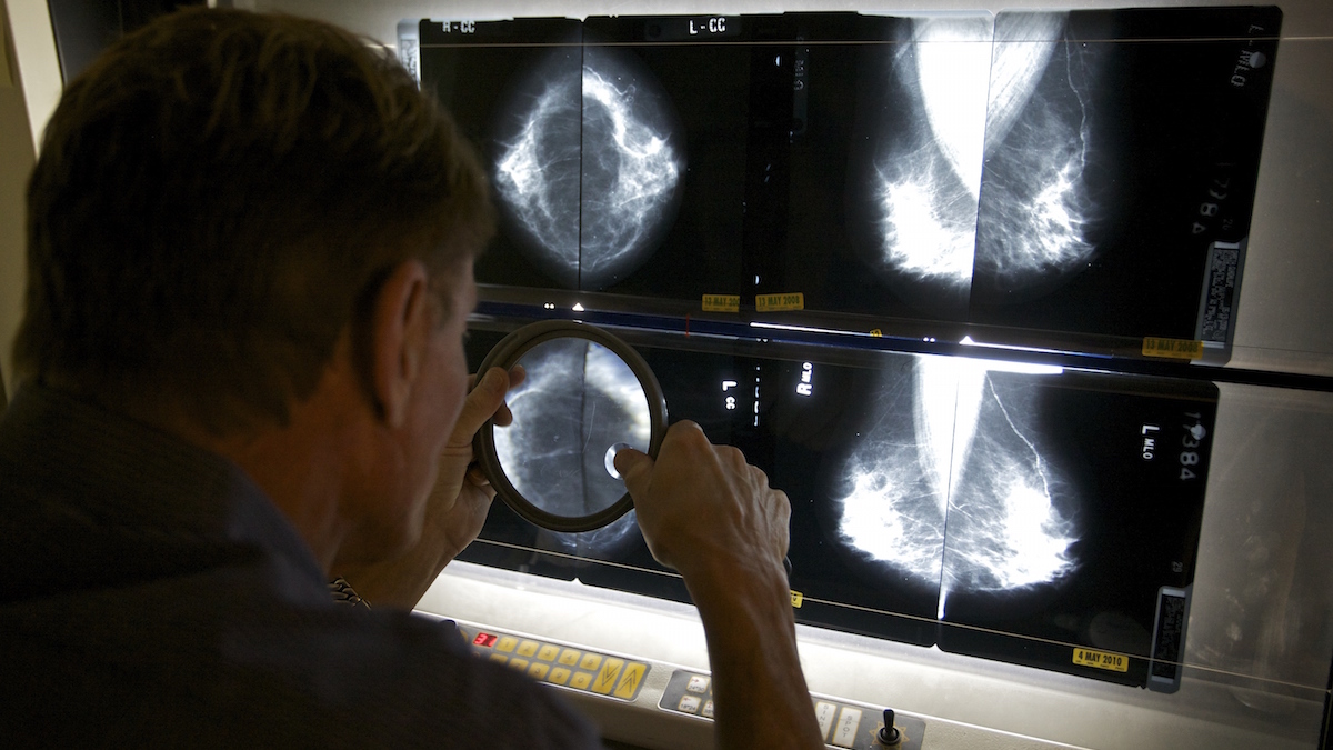 mammograms did not meet standards  NBC 6 South Florida [Video]