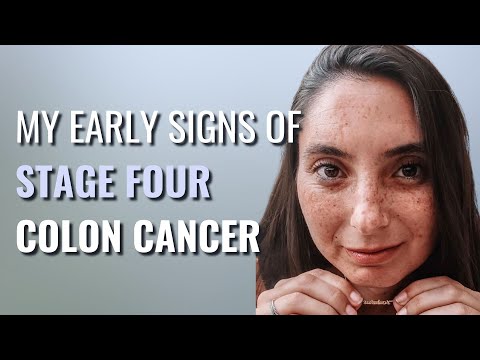 Constipation To STAGE 4 CANCER! – Elizabeth | Stage 4 Colon Cancer | The Patient Story [Video]