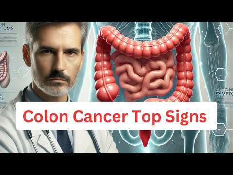 Colon Cancer Alert: 5 Warning Signs You Must Know [Video]