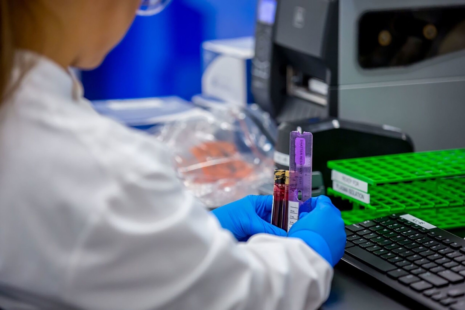 New colon cancer blood test could move a step closer to FDA approval in the US [Video]