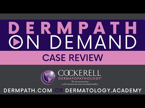 Case Review | Episode 27 [Video]