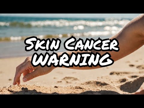 Warning: Skin Cancer Symptoms You Should NEVER Ignore(MUST WATCH) #skincancer,#skincancerprevention [Video]