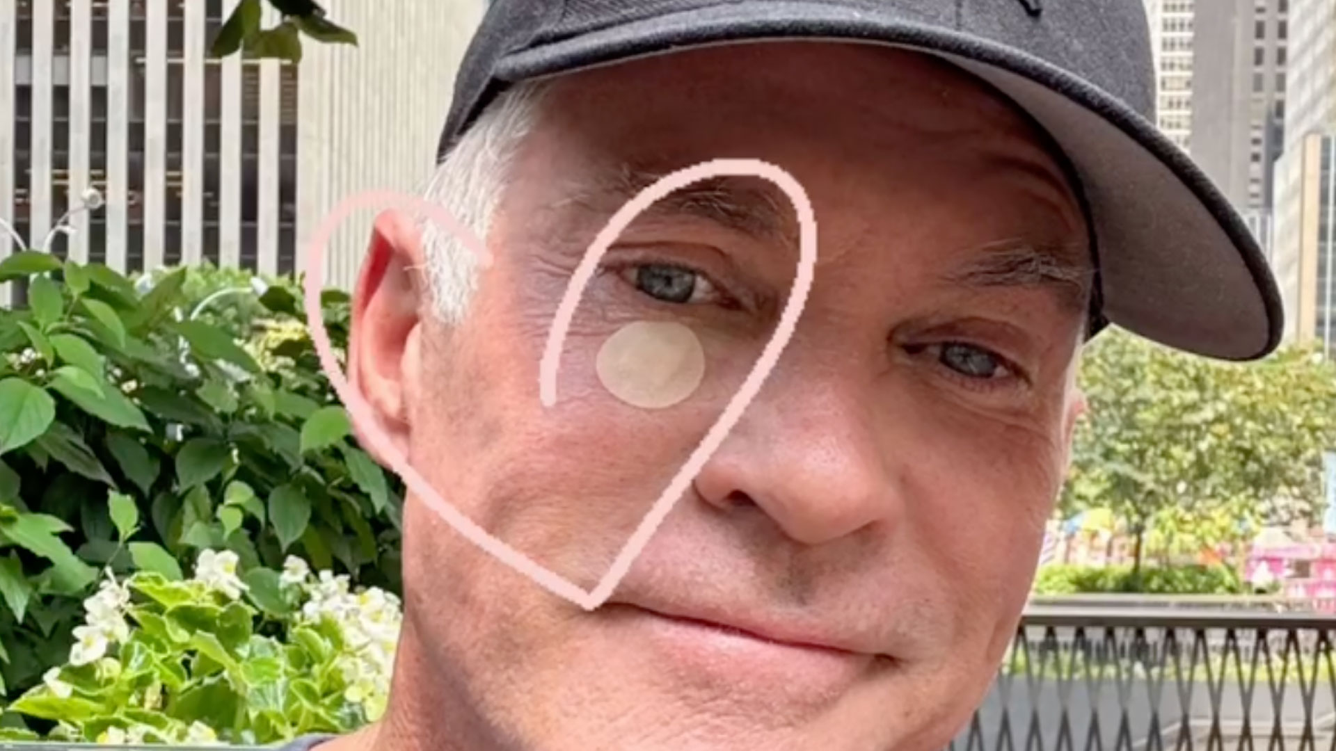 GMAs Sam Champion reveals he had skin cancer cut out from his face in concerning new photo & begs fans get checked [Video]
